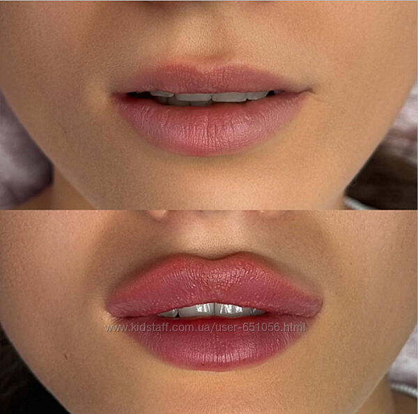 Курс по контурной пластике губ Расита Хапачева