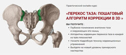 Перекос таза Пошаговый алгоритм коррекции в 3D 2025 Дмитрий Семенов