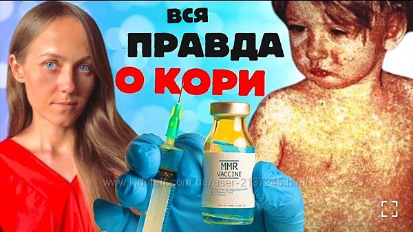 Екатерина Сугак Вся правда о кори 2024
